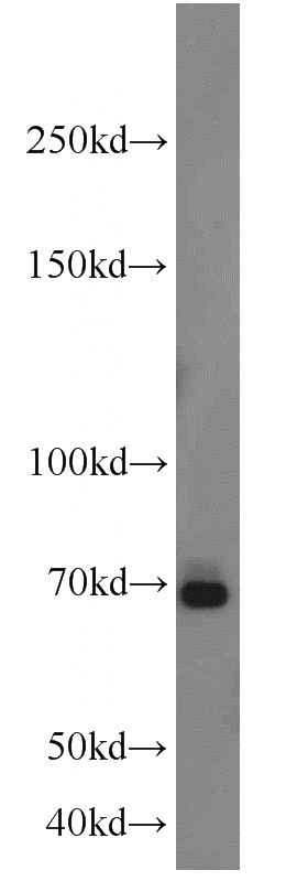A431 cells were subjected to SDS PAGE followed by western blot with Catalog No:110155(E2F4 antibody) at dilution of 1:1000