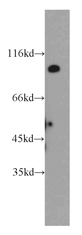 mouse brain tissue were subjected to SDS PAGE followed by western blot with Catalog No:116616(UNC5A-Specific antibody) at dilution of 1:100