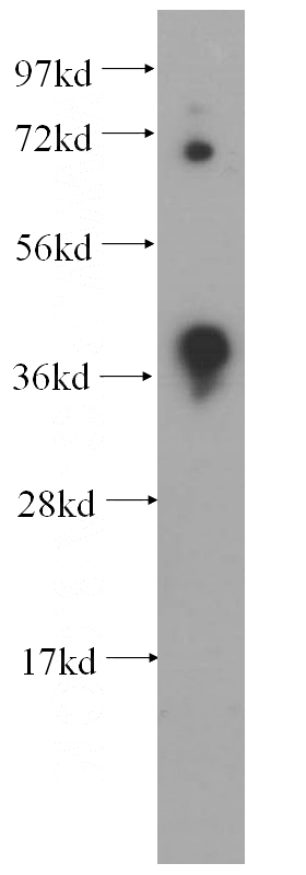 PC-3 cells were subjected to SDS PAGE followed by western blot with Catalog No:109970(DNMT3L antibody) at dilution of 1:300