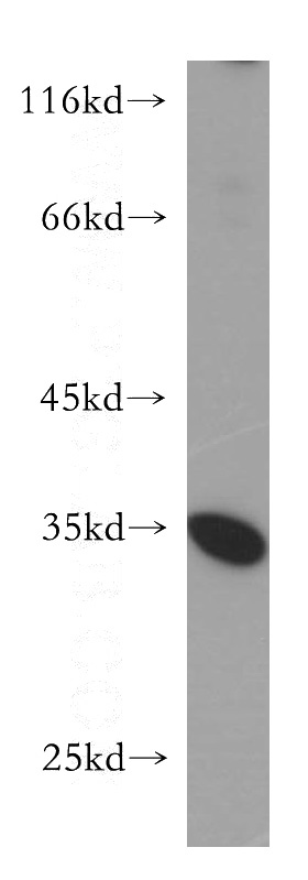 HepG2 cells were subjected to SDS PAGE followed by western blot with Catalog No:114370(PSKH2 antibody) at dilution of 1:600