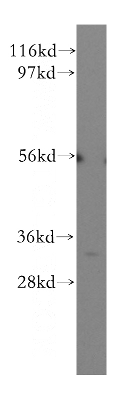HEK-293 cells were subjected to SDS PAGE followed by western blot with Catalog No:108321(ATPAF2 antibody) at dilution of 1:500