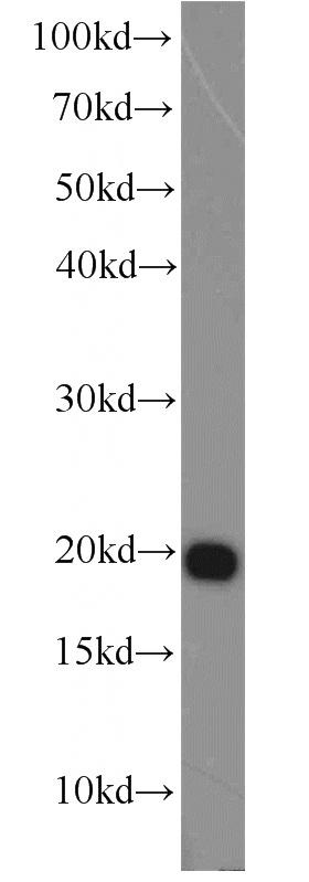 HeLa cells were subjected to SDS PAGE followed by western blot with Catalog No:108224(ASF1B antibody) at dilution of 1:1000