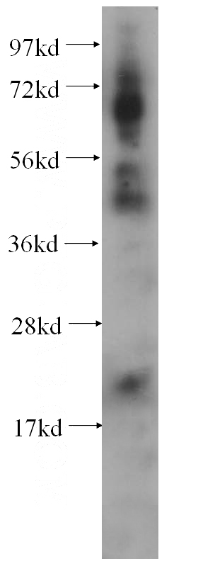 human brain tissue were subjected to SDS PAGE followed by western blot with Catalog No:113740(PCK2 antibody) at dilution of 1:200