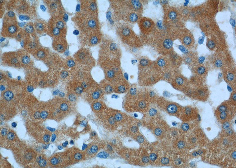 Immunohistochemistry of paraffin-embedded human liver tissue slide using Catalog No:112355(LSS Antibody) at dilution of 1:50 (under 40x lens)