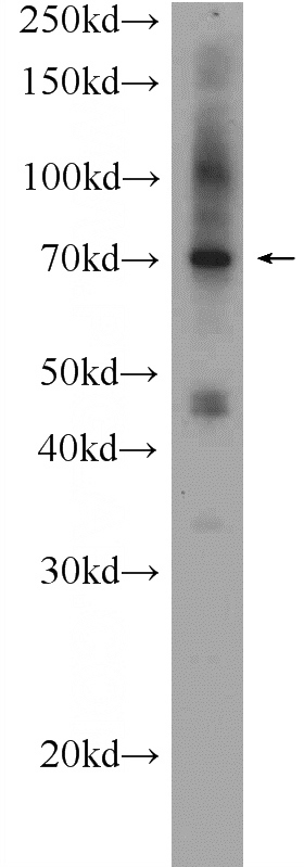 mouse cerebellum tissue were subjected to SDS PAGE followed by western blot with Catalog No:107951(AKTIP Antibody) at dilution of 1:300