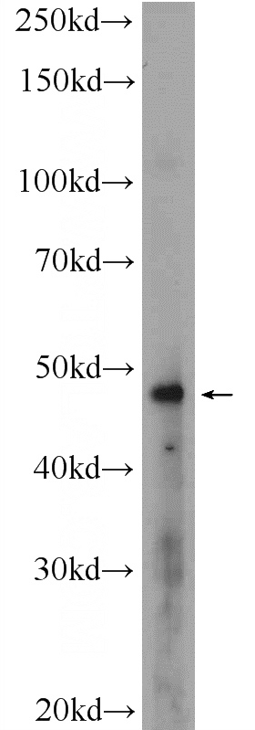 A431 cells were subjected to SDS PAGE followed by western blot with Catalog No:112572(MDM2 Antibody) at dilution of 1:300