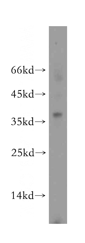 Apoptosised HeLa cells were subjected to SDS PAGE followed by western blot with Catalog No:113787(PGLYRP3 antibody) at dilution of 1:500