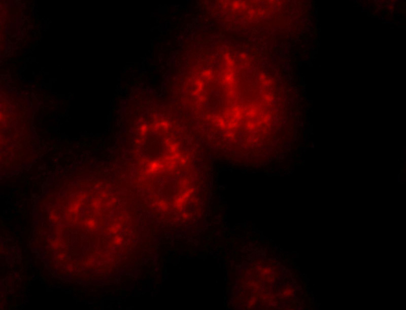 Immunofluorescent analysis of Hela cells, using C21orf66 antibody Catalog No:108708 at 1:25 dilution and Rhodamine-labeled goat anti-rabbit IgG (red).