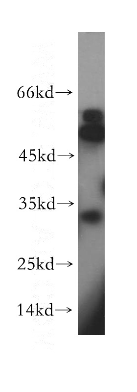 human skeletal muscle tissue were subjected to SDS PAGE followed by western blot with Catalog No:114668(RDH12 antibody) at dilution of 1:200