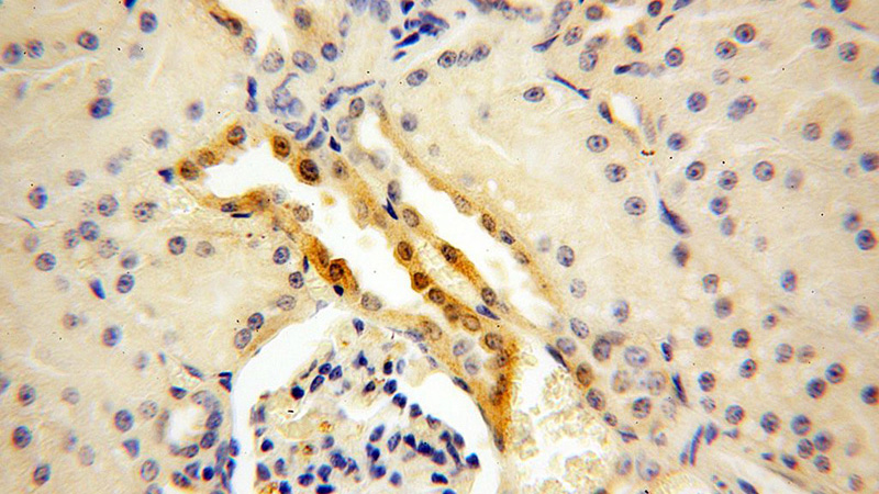 Immunohistochemical of paraffin-embedded human kidney using Catalog No:113521(OVCA2 antibody) at dilution of 1:50 (under 40x lens)