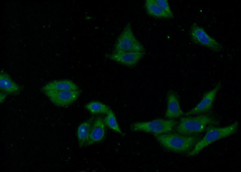 Immunofluorescent analysis of HepG2 cells using Catalog No:115084(SEC61A2 Antibody) at dilution of 1:25 and Alexa Fluor 488-congugated AffiniPure Goat Anti-Rabbit IgG(H+L)