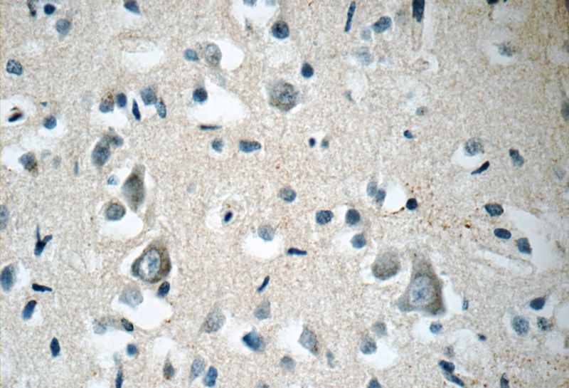 Immunohistochemistry of paraffin-embedded human brain tissue slide using Catalog No:108186(ARHGEF4 Antibody) at dilution of 1:50 (under 40x lens)