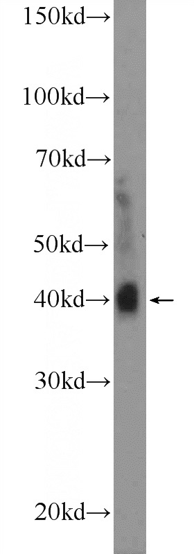mouse brain tissue were subjected to SDS PAGE followed by western blot with Catalog No:114852(RSPO3 Antibody) at dilution of 1:300