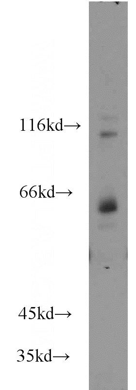 mouse brain tissue were subjected to SDS PAGE followed by western blot with Catalog No:115907(TCF7L1 antibody) at dilution of 1:1000