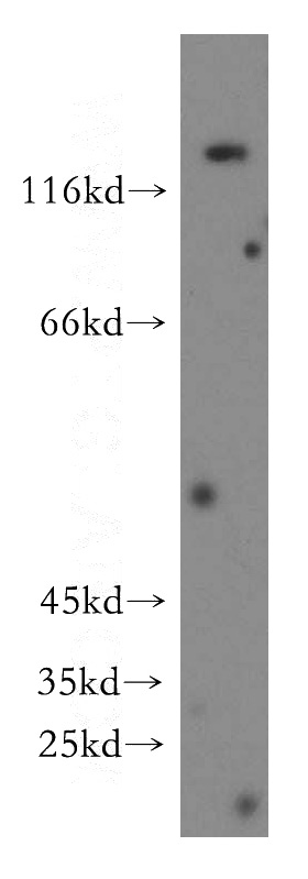 human skeletal muscle tissue were subjected to SDS PAGE followed by western blot with Catalog No:109438(COL6A1 antibody) at dilution of 1:500