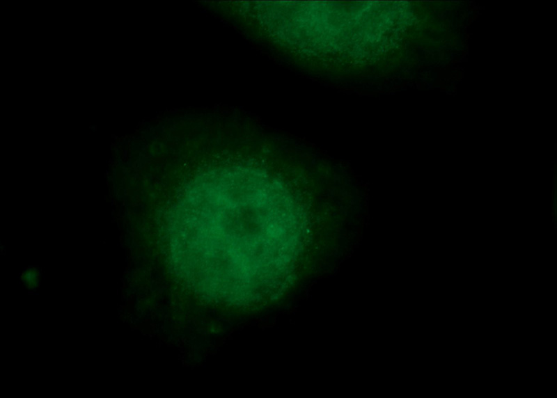 Immunofluorescent analysis of HEK-293 cells using Catalog No:107590(SMARCE1 Antibody) at dilution of 1:50 and Rhodamine-Goat anti-Mouse IgG