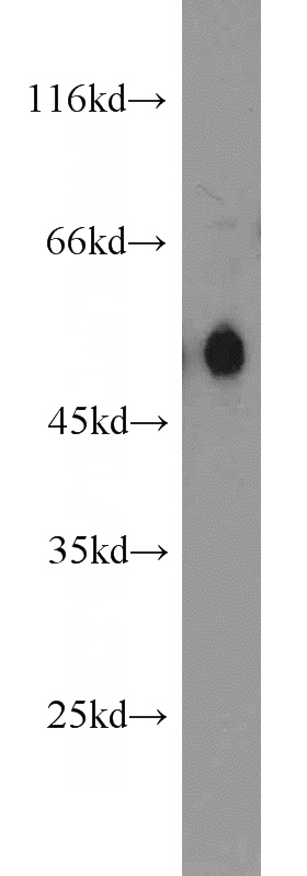 HEK-293 cells were subjected to SDS PAGE followed by western blot with Catalog No:108853(CPM antibody) at dilution of 1:600