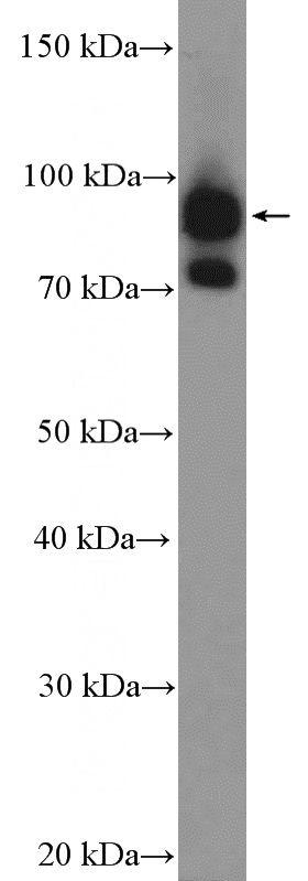 U-251 cells were subjected to SDS PAGE followed by western blot with Catalog No:110245(ENAH Antibody) at dilution of 1:2000