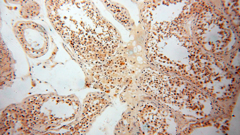 Immunohistochemical of paraffin-embedded human testis using Catalog No:116953(ZNF174 antibody) at dilution of 1:100 (under 10x lens)