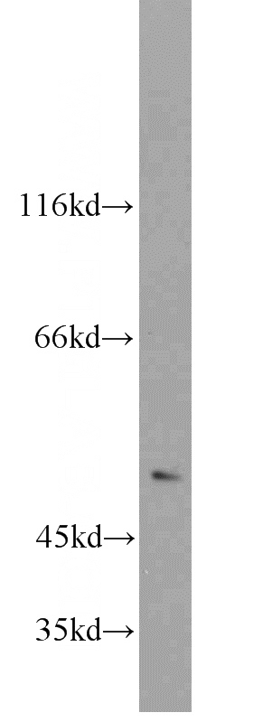 mouse thymus tissue were subjected to SDS PAGE followed by western blot with Catalog No:109279(CHRNA3 antibody) at dilution of 1:1000