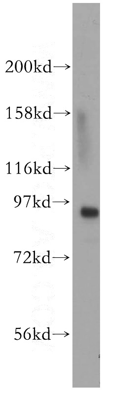 HeLa cells were subjected to SDS PAGE followed by western blot with Catalog No:112554(MCM4 antibody) at dilution of 1:600
