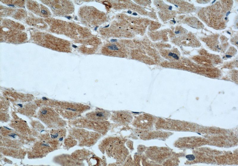Immunohistochemical of paraffin-embedded human heart using Catalog No:107215(FBLN5 antibody) at dilution of 1:50 (under 40x lens)