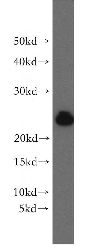 human brain tissue were subjected to SDS PAGE followed by western blot with Catalog No:114406(RAB11B-Specific antibody) at dilution of 1:300