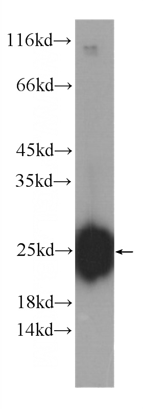 fetal human brain tissue were subjected to SDS PAGE followed by western blot with Catalog No:107203(FAM3C Antibody) at dilution of 1:1000