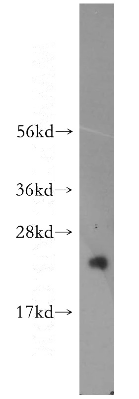 HepG2 cells were subjected to SDS PAGE followed by western blot with Catalog No:112418(LZIC antibody) at dilution of 1:400