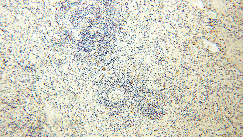 Immunohistochemical of paraffin-embedded human spleen using Catalog No:109057(CD40LG antibody) at dilution of 1:100 (under 10x lens)
