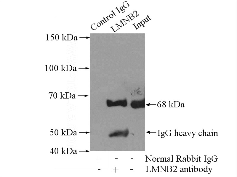 IP Result of anti-LMNB2 (IP:Catalog No:112282, 3ug; Detection:Catalog No:112282 1:500) with Jurkat cells lysate 2400ug.