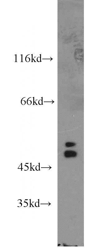 mouse kidney tissue were subjected to SDS PAGE followed by western blot with Catalog No:109700(CYP3A4 antibody) at dilution of 1:800