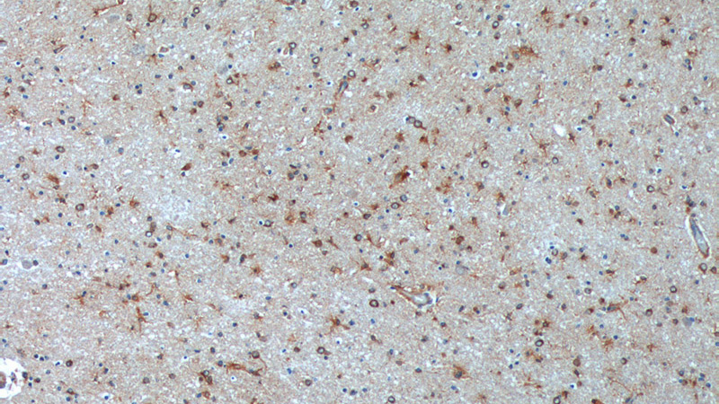 Immunohistochemistry of paraffin-embedded human brain tissue slide using Catalog No:110964(GHDC Antibody) at dilution of 1:200 (under 10x lens)