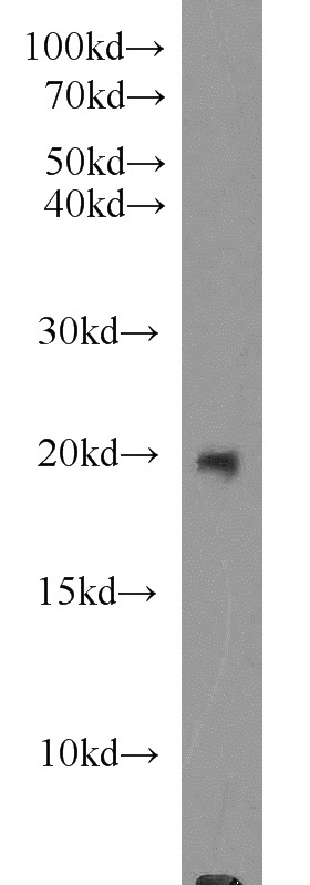 SKOV-3 cells were subjected to SDS PAGE followed by western blot with Catalog No:112704(MMP26 antibody) at dilution of 1:1000