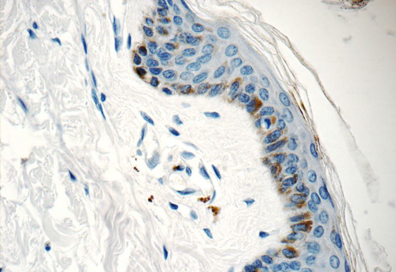 Immunohistochemistry of paraffin-embedded human skin tissue slide using Catalog No:108790(C7orf49 Antibody) at dilution of 1:25 (under 40x lens)