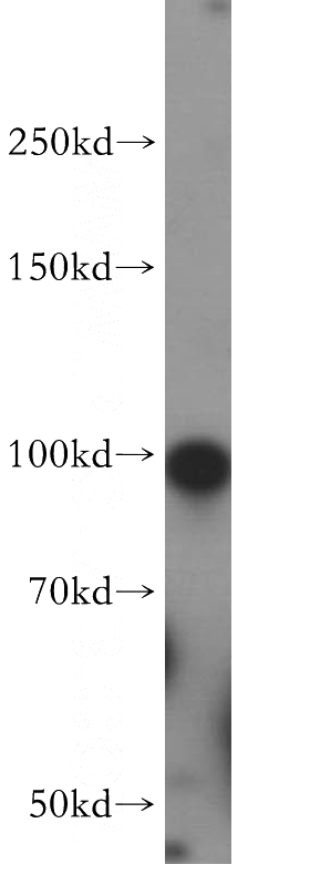 HEK-293 cells were subjected to SDS PAGE followed by western blot with Catalog No:111021(GLI2-Specific antibody) at dilution of 1:400