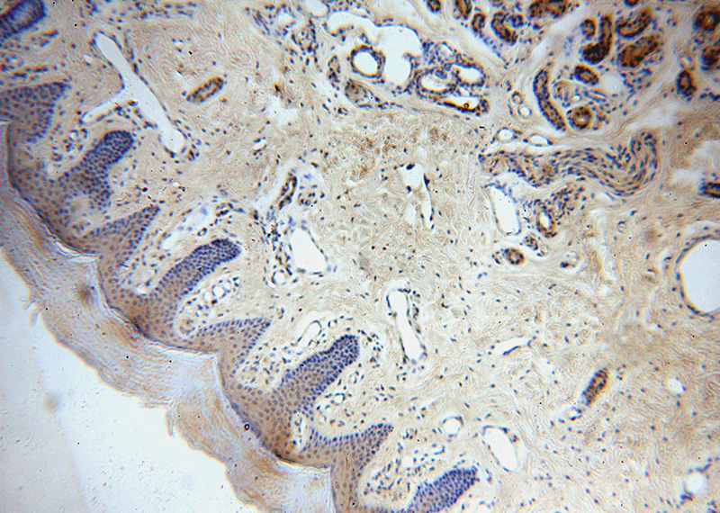 Immunohistochemical of paraffin-embedded human skin using Catalog No:108987(CCDC72 antibody) at dilution of 1:50 (under 10x lens)