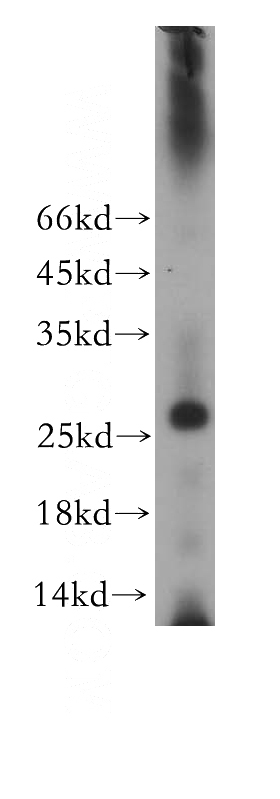 mouse pancreas tissue were subjected to SDS PAGE followed by western blot with Catalog No:114500(RABL2A antibody) at dilution of 1:300