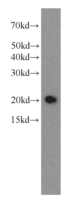 human brain tissue were subjected to SDS PAGE followed by western blot with Catalog No:107609(STMN3 antibody) at dilution of 1:1000