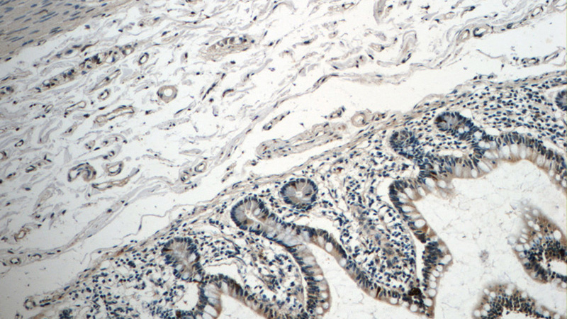 Immunohistochemistry of paraffin-embedded human small intestine tissue slide using Catalog No:110082(DNAH6 Antibody) at dilution of 1:50 (under 10x lens)