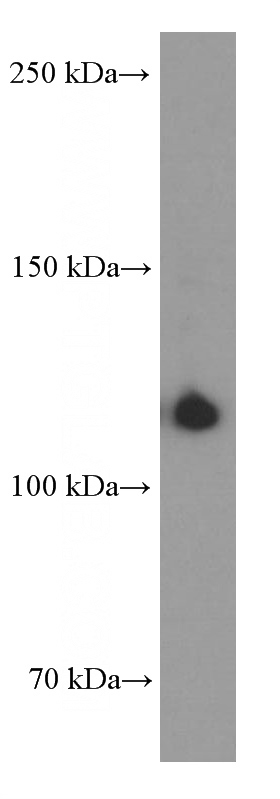 human spleen tissue were subjected to SDS PAGE followed by western blot with Catalog No:107134(CD41/Integrin alpha 2b Antibody) at dilution of 1:1600