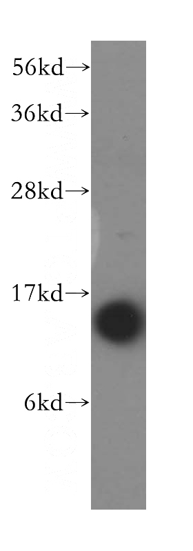 HepG2 cells were subjected to SDS PAGE followed by western blot with Catalog No:114829(RPS14 antibody) at dilution of 1:1000