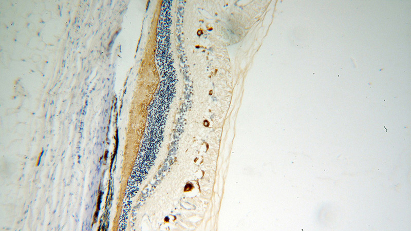 Immunohistochemical of paraffin-embedded human eye using Catalog No:114561(RBP3 antibody) at dilution of 1:50 (under 10x lens)