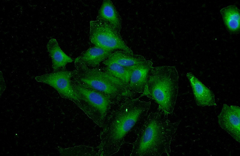 Immunofluorescent analysis of A549 cells using Catalog No:109862(DAPK1 Antibody) at dilution of 1:50 and Alexa Fluor 488-congugated AffiniPure Goat Anti-Rabbit IgG(H+L)