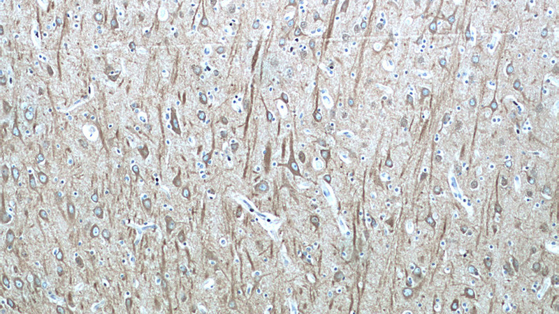 Immunohistochemistry of paraffin-embedded human brain tissue slide using Catalog No:117308(Tubulin-beta Antibody) at dilution of 1:400 (under 10x lens)
