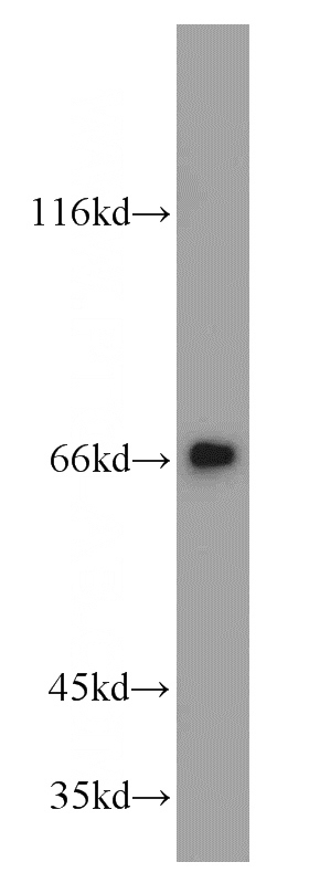 mouse brain tissue were subjected to SDS PAGE followed by western blot with Catalog No:112838(KIAA0391 antibody) at dilution of 1:800