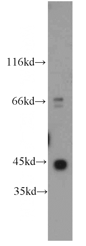 HeLa cells were subjected to SDS PAGE followed by western blot with Catalog No:110854(ACTG1 antibody) at dilution of 1:500