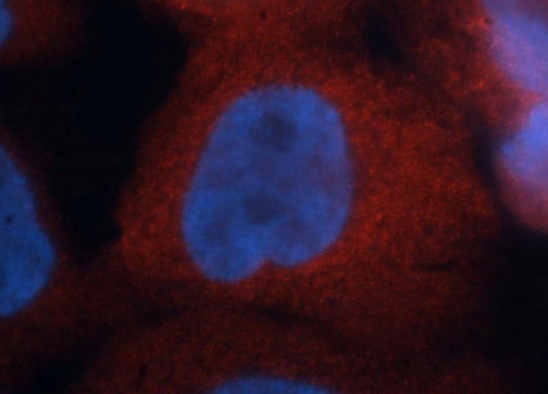 Immunofluorescent analysis of A431 cells, using AHSA1 antibody Catalog No:107847 at 1:50 dilution and Rhodamine-labeled goat anti-rabbit IgG (red). Blue pseudocolor = DAPI (fluorescent DNA dye).