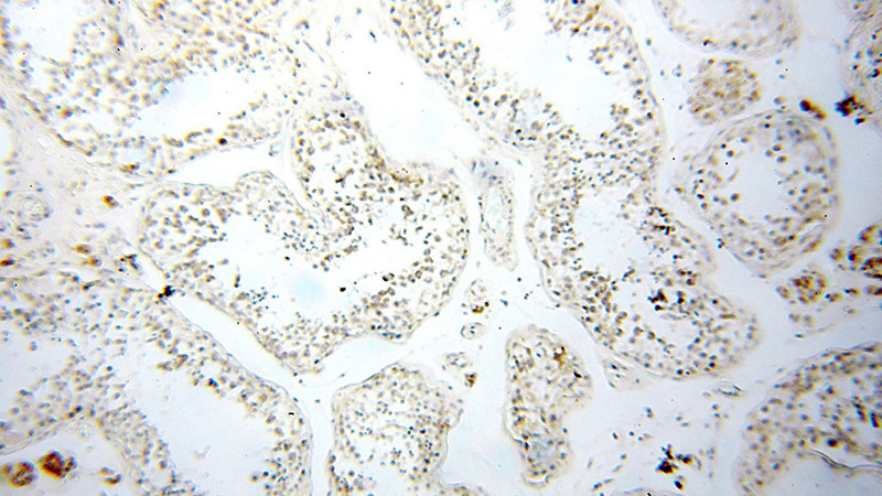 Immunohistochemical of paraffin-embedded human testis using Catalog No:109329(KIT antibody) at dilution of 1:400 (under 10x lens)