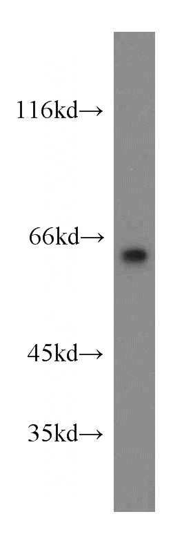 human brain tissue were subjected to SDS PAGE followed by western blot with Catalog No:112206(LGI1 antibody) at dilution of 1:300